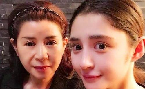 明星整容事件,揭秘娱乐圈美丽背后的真相